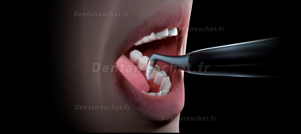 Woodpecker AP-2 PLUS Pièce à main sous-gingivale détachable pour aéropolisseur dentaire