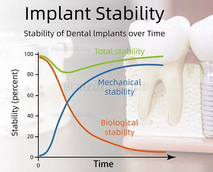 YAHOPE iCHECK Moniteur de Stabilité Implantaire ISQ Implant Stability Measurement Module